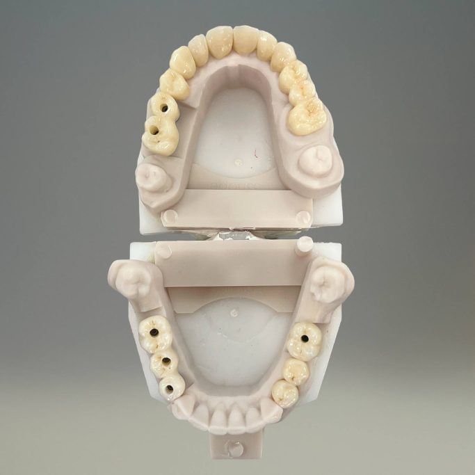 Full Zircone
