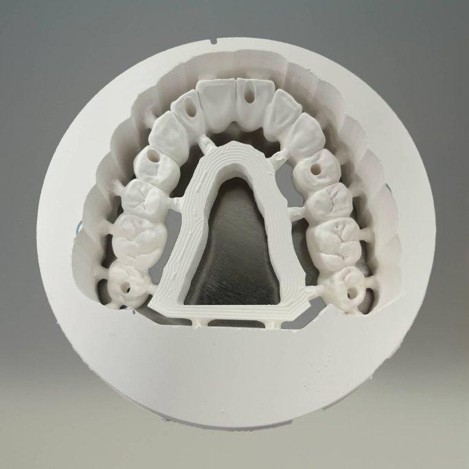Usinage Complet Zircone Usinage Complet Zircone